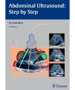 Abdominal Ultrasound Step by Step