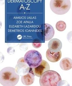 Dermatoscopy A Z
