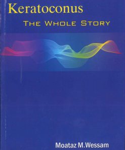 Keratoconus  The Whole Story