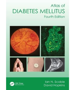 Atlas of Diabetes Mellitus