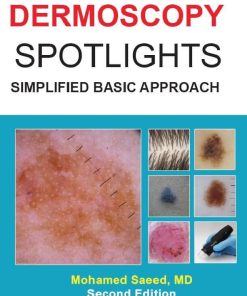 Dermoscopy Spotlights Simplified Basic Approach 2nd Edition