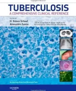 Tuberculosis A Comprehensive Clinical Reference