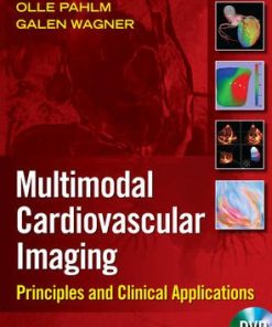 Cardiovascular Multimodal Image Guided Diagnosis And Therapy