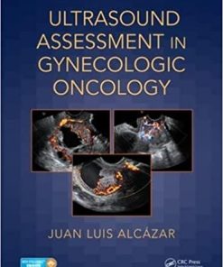 Ultrasound Assessment in Gynecologic Oncology
