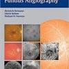 Atlas of Fundus Angiography