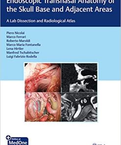 Endoscopic Transnasal Anatomy of the Skull Base and Adjacent Areas A Lab Dissection and Radiological Atlas