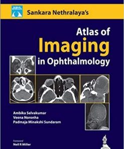 Sankara Nethralaya Atlas of Imaging in Ophthalmology