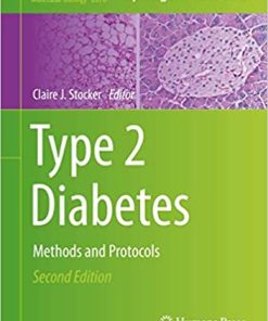 Type 2 Diabetes Methods and Protocols 2nd Edition