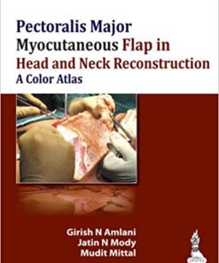 Pectoralis Major Myocutaneous Flap in Head and Neck Reconstruction A Color Atlas