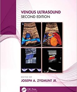 Venous Ultrasound 2nd Edition