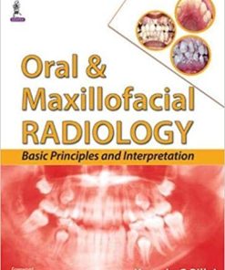 Oral & Maxillofacial Radiology: Basic Principles and Interpretation By Kamala G Pillai