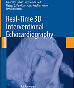 Real Time 3D Interventional Echocardiography