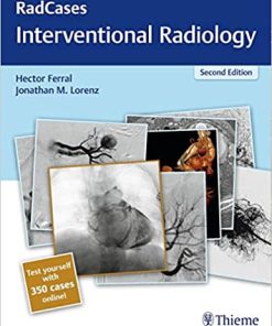 Radcases Interventional Radiology 2nd Edition