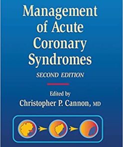 Management of Acute Coronary Syndromes 2nd Edition