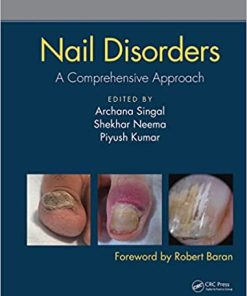 Nail Disorders A Comprehensive Approach