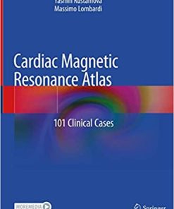 Cardiac Management in the Frail Elderly Patient and the Oldest Old