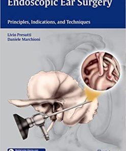 Endoscopic Ear Surgery Principles Indications and Techniques
