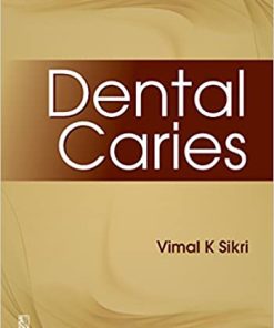 DENTAL CARIES By V.K. Sikri