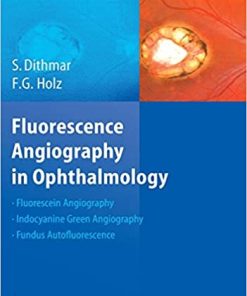 Fluorescence Angiography In Ophthalmology
