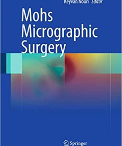 Mohs Micrographic Surgery