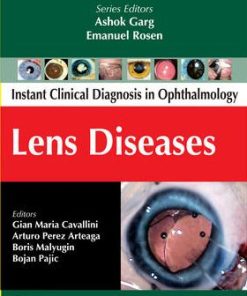 Lens Disease