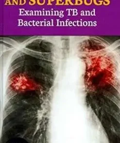 Tuberculosis and Superbugs Examining TB and Bacterial Infections