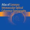 Atlas of Coronary Intravascular Optical Coherence Tomography