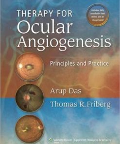 Therapy for Ocular Angiogenesis Principles and Practice