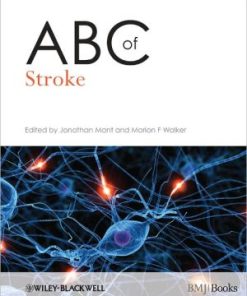 ABC of Stroke