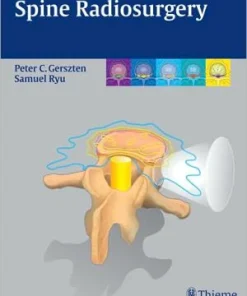 Spine Radiosurgery