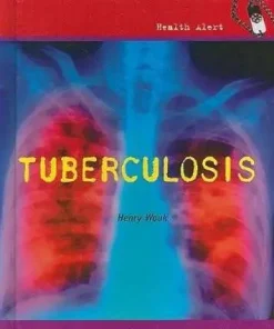 Tuberculosis By Henry Wouk