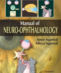 Manual of Neuro Ophthalmology