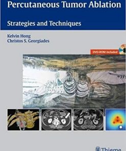 Percutaneous Tumor Ablation Strategies and Techniques