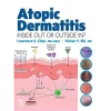 Elsevier Atopic Dermatitis: Inside Out or Outside In