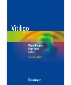 Vitiligo