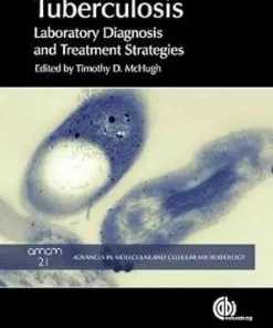 Tuberculosis Laboratory Diagnosis and Treatment Strategies