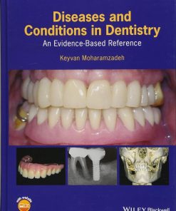 Diseases and Conditions in Dentistry An Evidence Based Reference