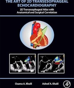 The Art of 2D Transesophageal Echocardiography 2D Transesophageal Atlas with Anatomical and Surgical Correlation