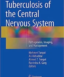 Tuberculosis of the Central Nervous System Pathogenesis Imaging and Management