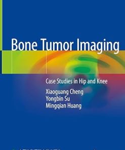 Bone Tumor Imaging