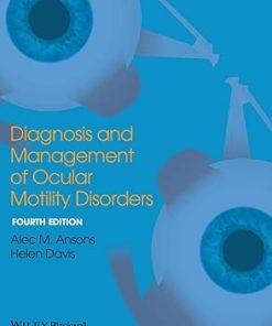 Diagnosis and Management of Ocular Motility Disorders