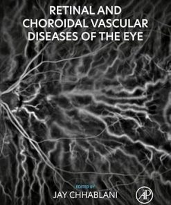 Retinal and Choroidal Vascular Diseases of the Eye