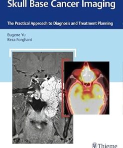 Skull Base Cancer Imaging