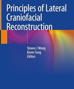 Principles of Lateral Craniofacial Reconstruction