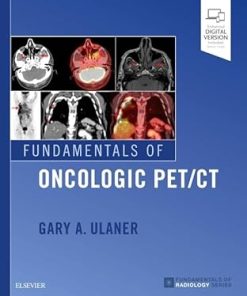 Oncologic PET/CT