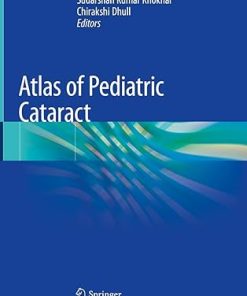 Atlas of Pediatric Cataract