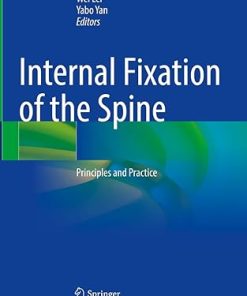 Internal Fixation of the Spine