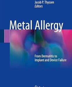 Metal Allergy From Dermatitis to Implant and Device Failure
