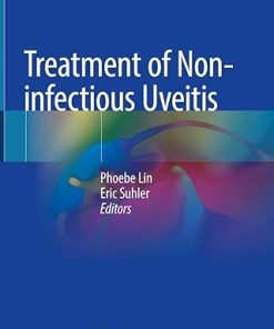 Treatment of Non-infectious Uveitis