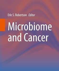 Microbiome and Cancer